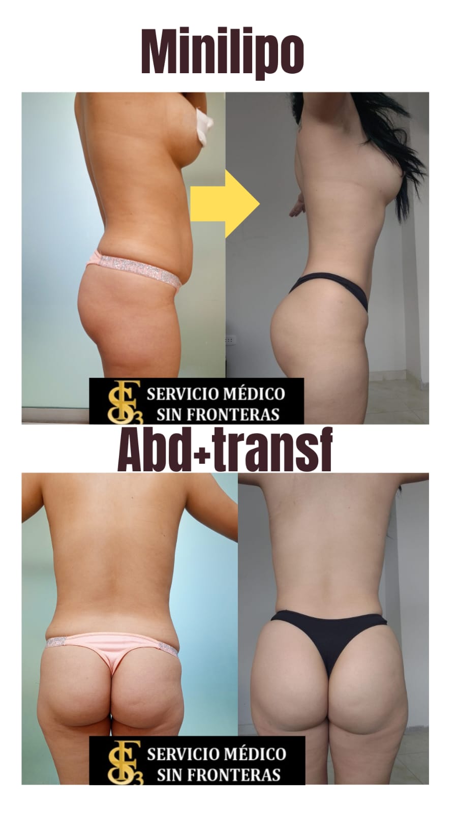 Resultado antes y después 1