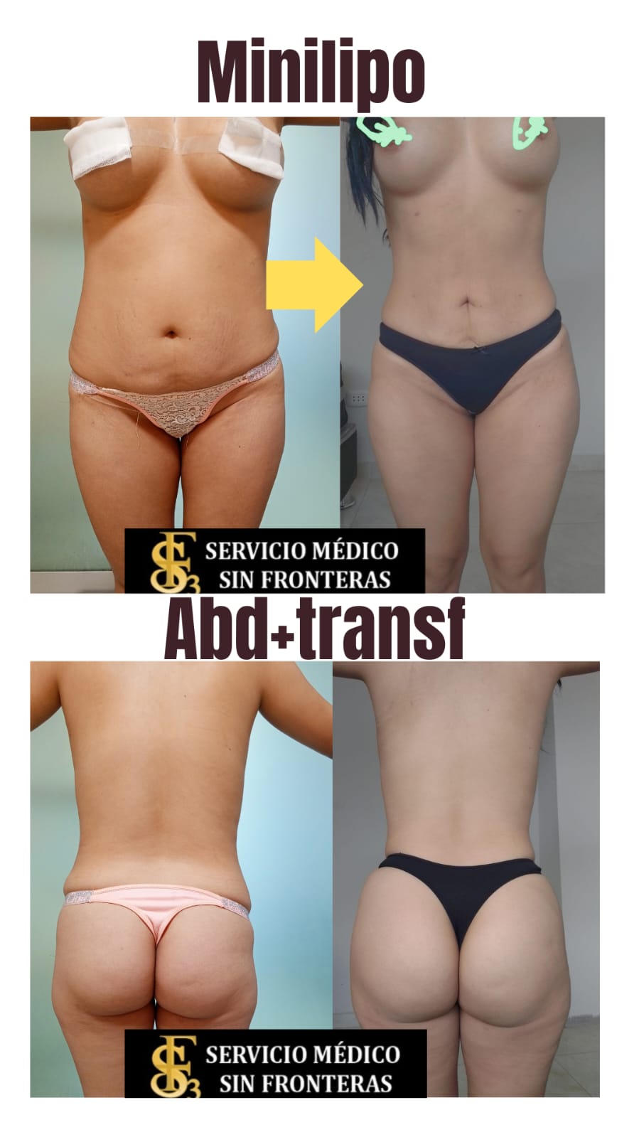 Resultado antes y después 2