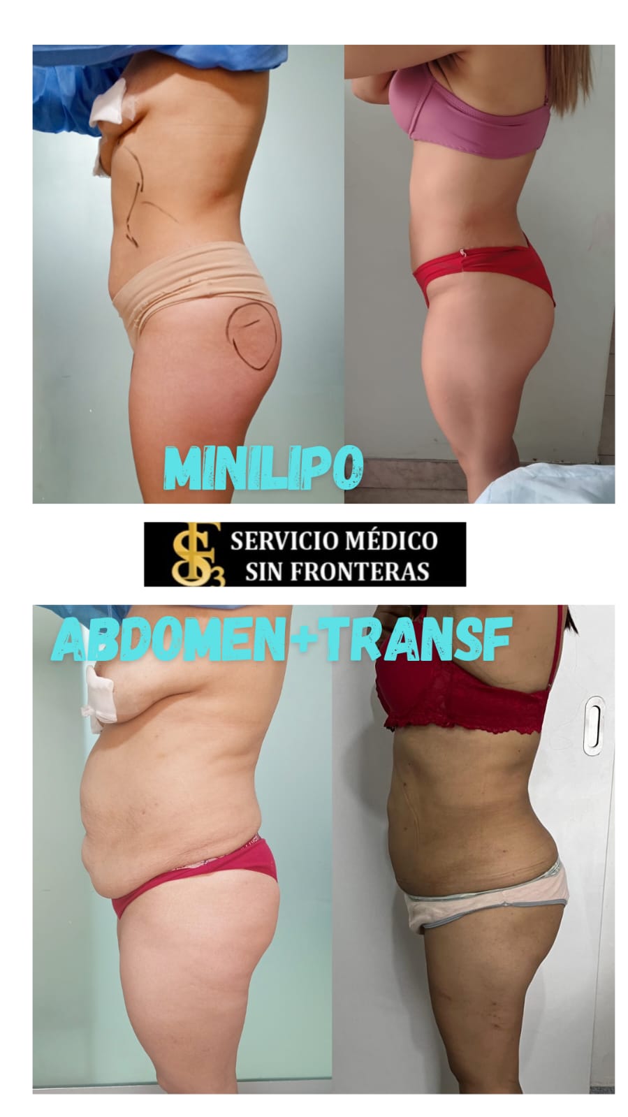 Resultado antes y después 4