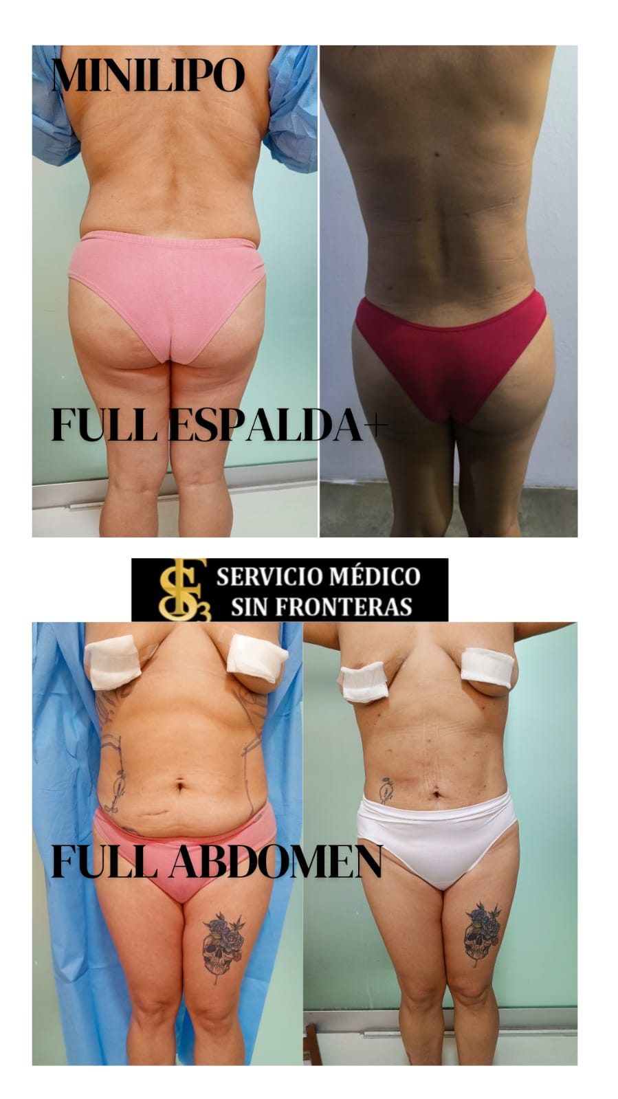 Resultado antes y después 5